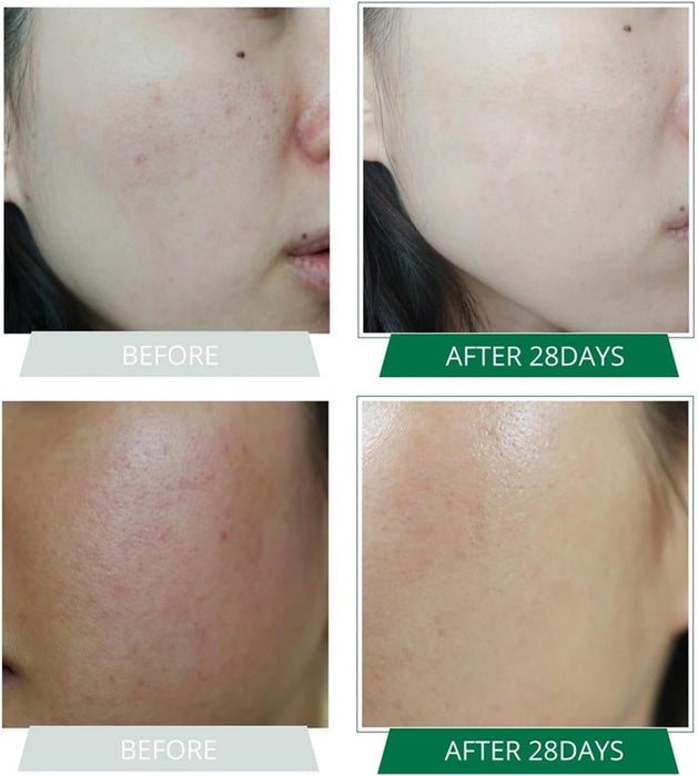 Recellme 28 Days Face Toner 100ml 3.4oz