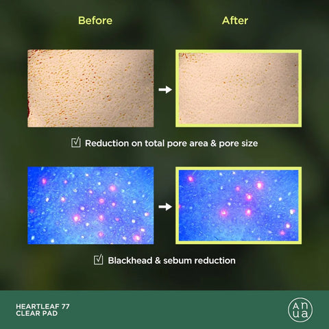 ANUA Heartleaf 77 Clear Pad 160ml/5.41 fl.oz.