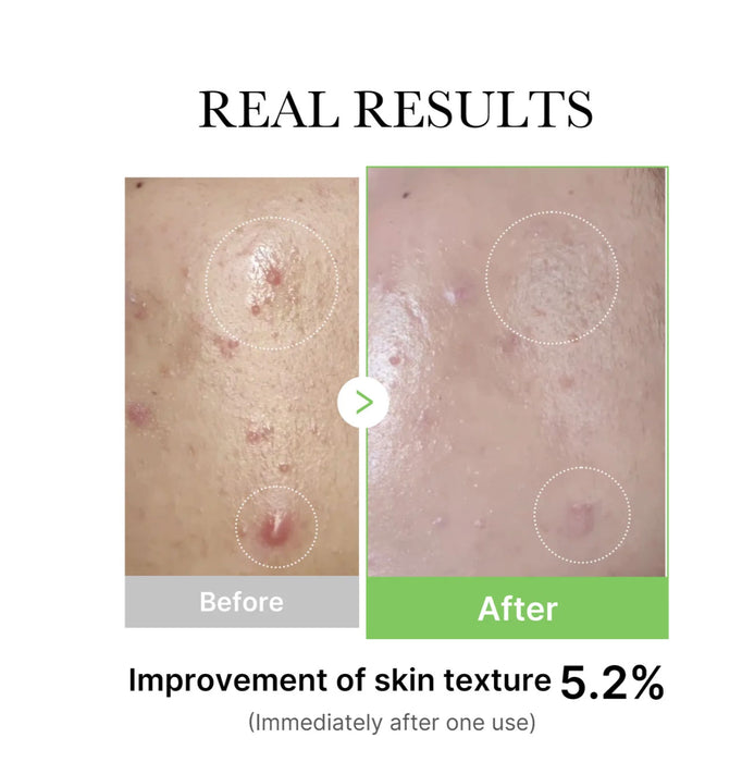 MEDICUBE Exosome Cica Ampoule