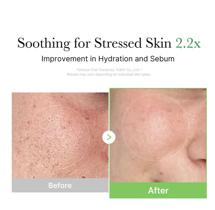 MEDICUBE Exosome Cica Cream