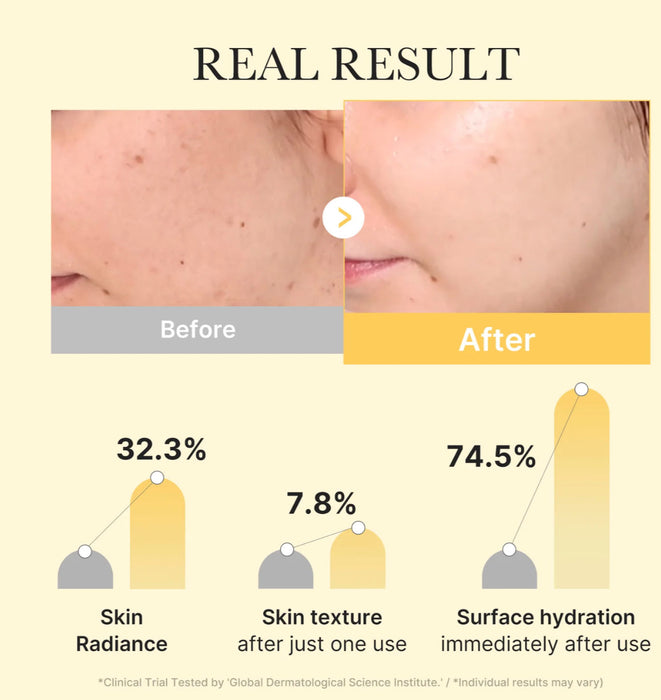 MEDICUBE Kojic Acid Turmeric Gold Jelly Gel Mask